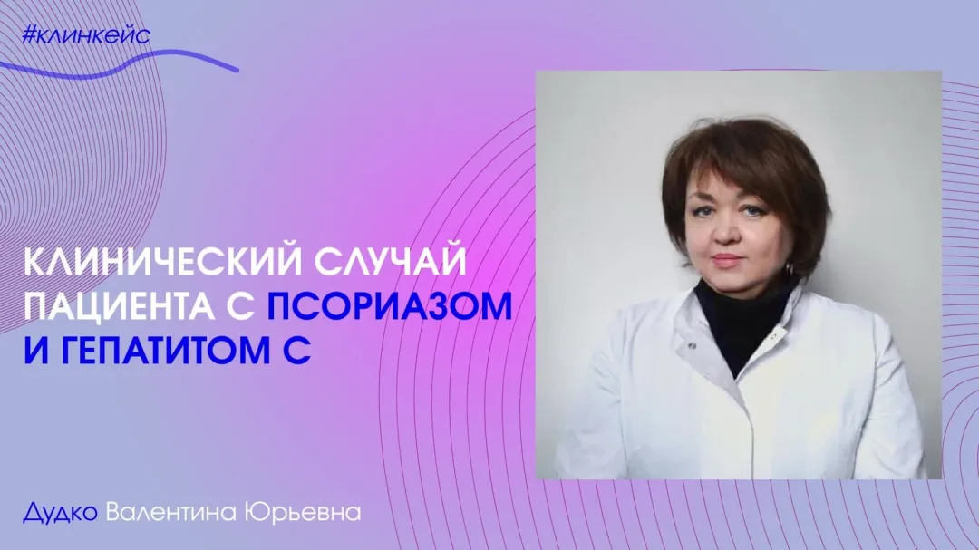 Дудко Валентина