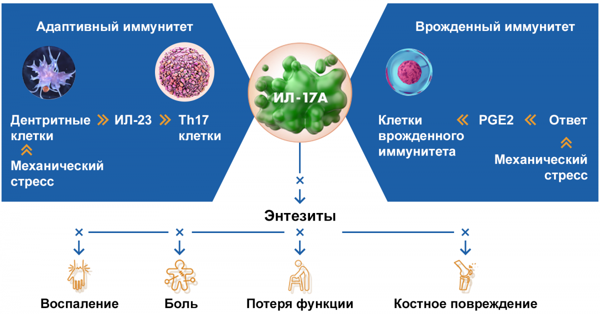 ИЛ-17А — ключевой цитокин развития энтезитов