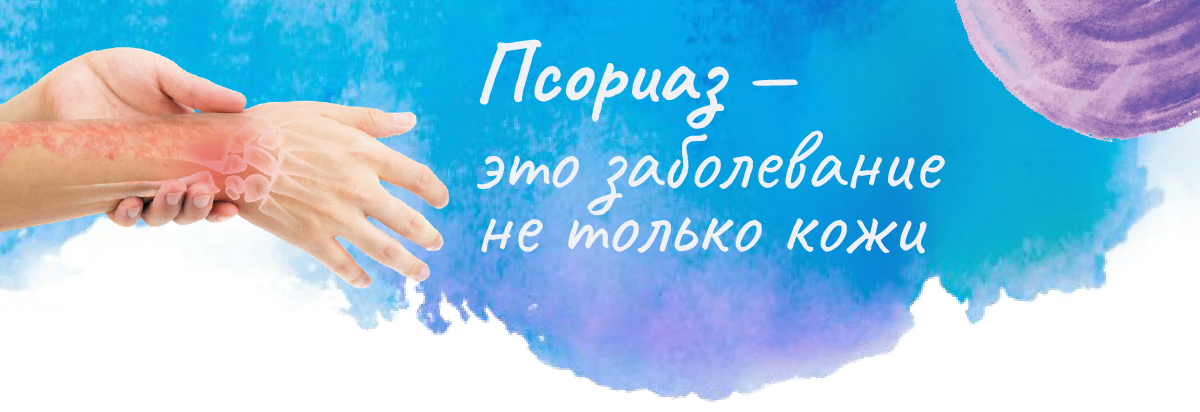Псориаз - это заболевание не только кожи