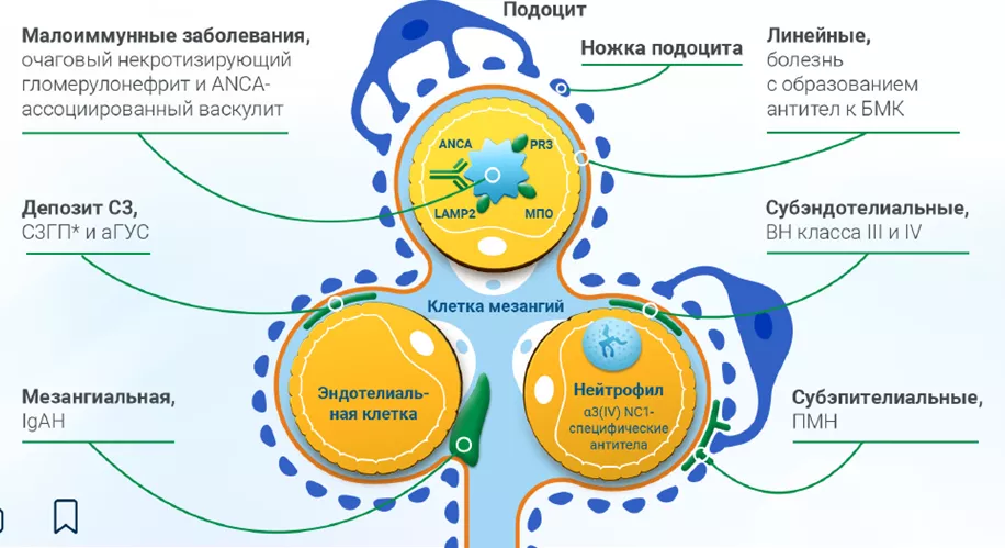Приложение 2. Локализация отложений комплемента определяет характер почечной патологии9..png