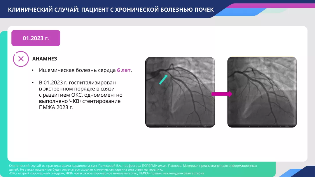 slide4