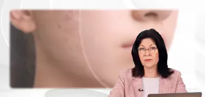 Ретиноиды и циклоспорин. Особенности терапии